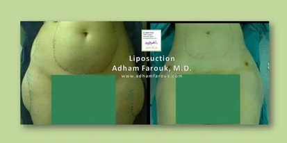 Promo Image 1