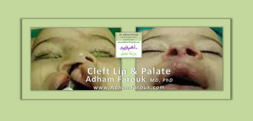 Promo Image 12