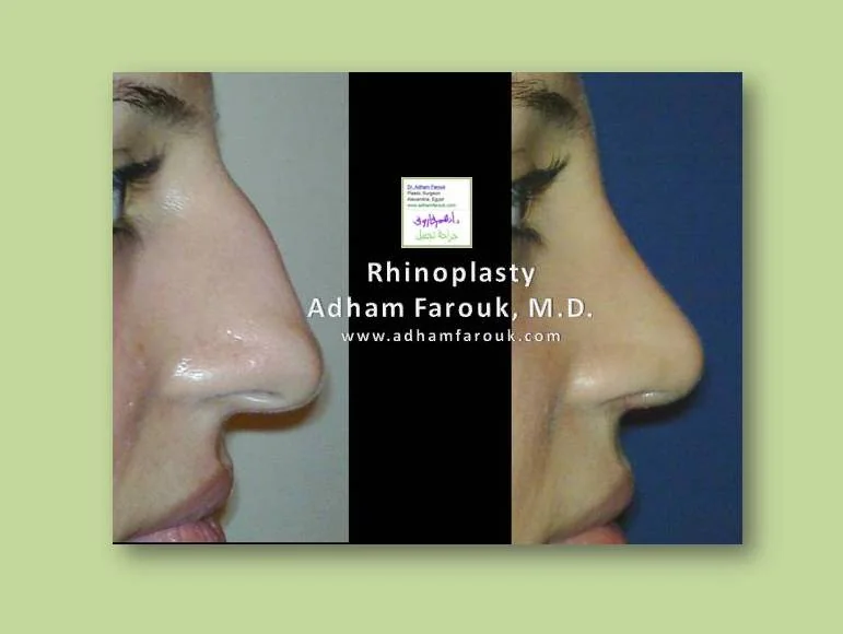 Promo Image 16